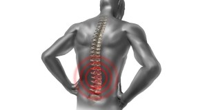 Alleviating Chronic Back Pain