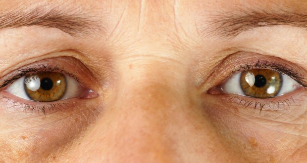 Are Dark Circles Making You Look Old and Tired?