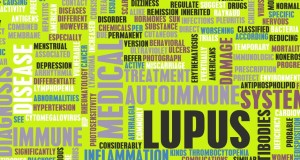 When the Body Attacks Itself: A Look at Lupus
