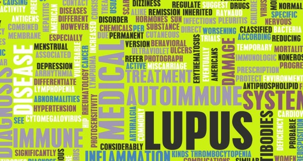 When the Body Attacks Itself: A Look at Lupus