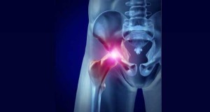 Shooting From the Hip: Treating Hip Flexor Strains