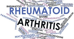 The Chronic Impact of Rheumatoid Arthritis
