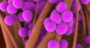 Is There a Superbug In Your Home?